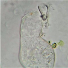 Cephalodella gibboides