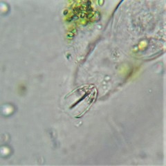 Cephalodella gibboides