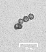 Akanthomyces tuberculatus
