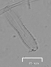 Nitzschia