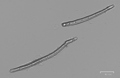 Microstoma protractum