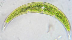 Closterium leibleinii