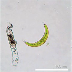 Closterium leibleinii