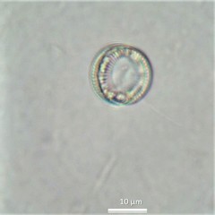 Cyclotella distinguenda