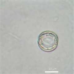 Cyclotella distinguenda