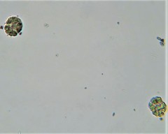 Gomphosphaeria aponina