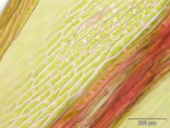 Imbribryum alpinum
