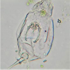 Lecane pyriformis
