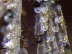 Folliculina
