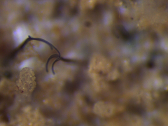 Folliculina