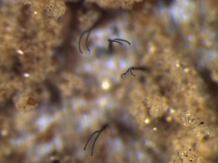 Folliculina
