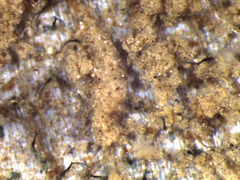 Folliculina