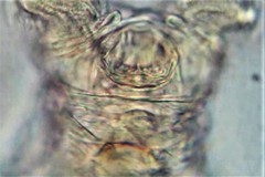 Philodina acuticornis odiosa