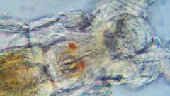 Philodina acuticornis odiosa