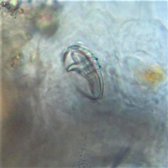 Philodina acuticornis odiosa