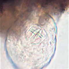 Philodina acuticornis odiosa