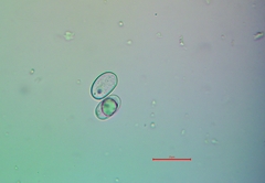 Aspicilia glaucopsina