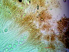 Aspicilia glaucopsina