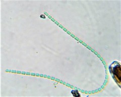 Pseudanabaena galeata