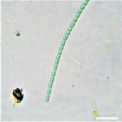 Pseudanabaena galeata