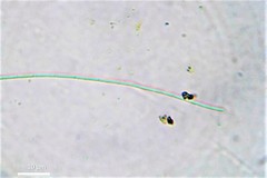 Pseudanabaena limnetica