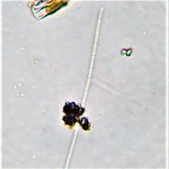 Pseudanabaena limnetica