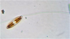Pseudanabaena limnetica
