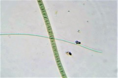 Pseudanabaena limnetica