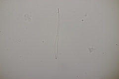 Cercospora mercurialis