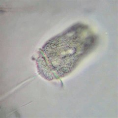 Pseudovorticella