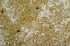 Puccinia graminis