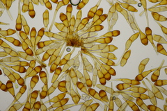 Puccinia graminis