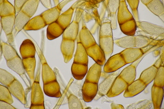Puccinia graminis