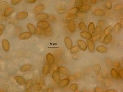 Glaucopodes
