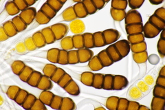 Phragmidium potentillae