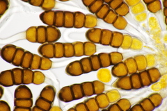 Phragmidium potentillae