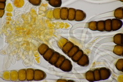 Phragmidium potentillae