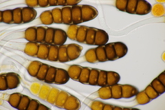 Phragmidium potentillae