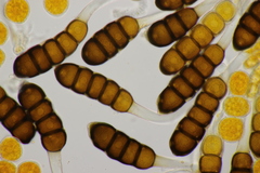 Phragmidium potentillae