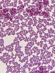 Staphylococcus epidermidis