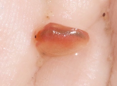 Cyzicidae
