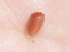 Cyzicidae