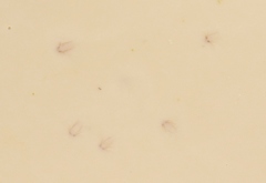 Cyzicidae