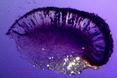 Diplotomma alboatrum