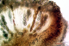 Diplotomma alboatrum