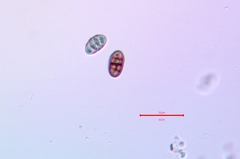 Diplotomma alboatrum