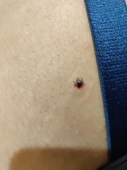 Rhipicephalus sanguineus