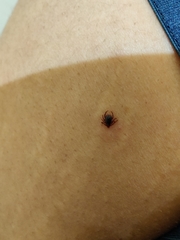 Rhipicephalus sanguineus