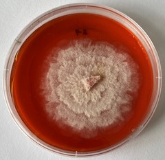 Pestalotiopsis vismiae
