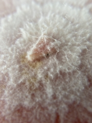 Pestalotiopsis vismiae